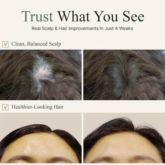 TS Gold Plus Shampoo | Hair Loss Shampoo with Biotin, Gold Extract & Niacinamide | Scalp Circulation & Volume Care | Sulfate-Free Korean Hair Care for Thinning Hair (17.6 Fl Oz / 500mL)