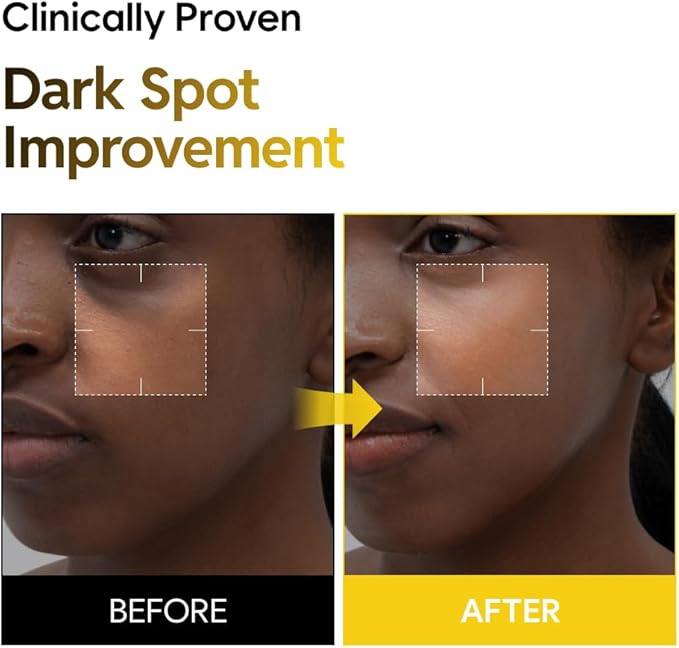 5% Niacinamide Milky Toner with Kojic Acid & Turmeric – Dark Spot Care, Skin Tone Improvement, Gentle Hydration for Face & Body, 200ml (6.76 fl oz)