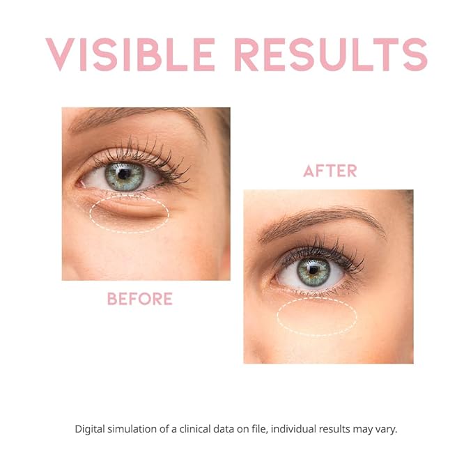 Caffeine Eye Cream Serum For Dark Circles and Puffiness, Eye Bag Treatment for Men & Women, Caffeine, Collagen, Vitamin E, Korean EVE Vegan Facial Serum Under Eye 30g