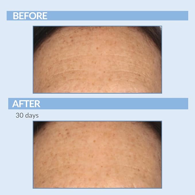 Retinol Vitamin A Resurfacing Pads for Daily Facial Treatment - Niacinamide & Witch Hazel - Exfoliates Skin & Pores - Reduces Fine Lines and Wrinkles - Serious Skincare - 60 Pre-Moistened Disc