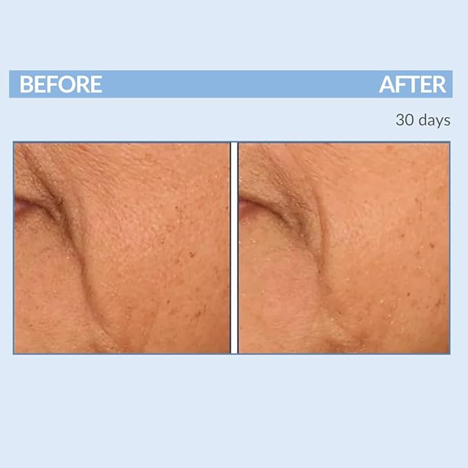 Retinol Vitamin A Resurfacing Pads for Daily Facial Treatment - Niacinamide & Witch Hazel - Exfoliates Skin & Pores - Reduces Fine Lines and Wrinkles - Serious Skincare - 60 Pre-Moistened Disc