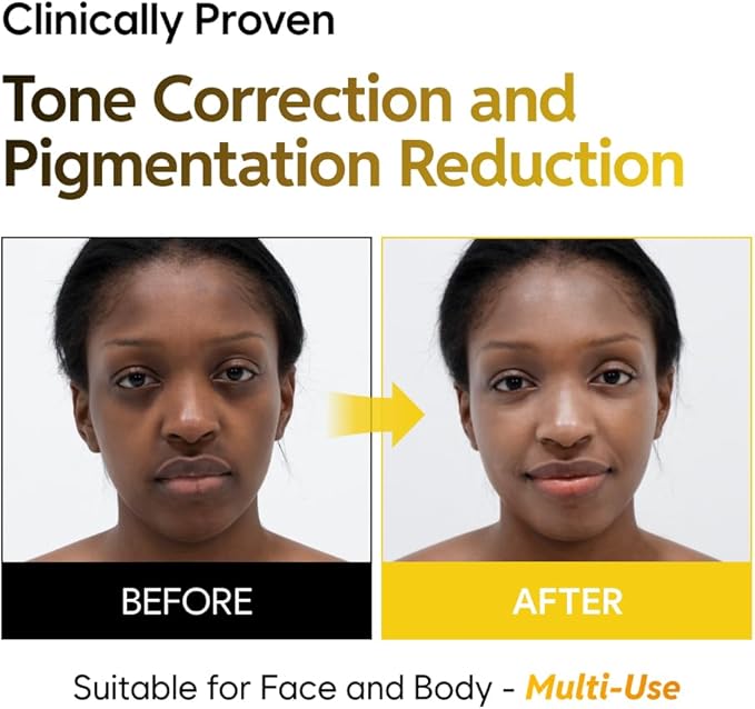 5% Niacinamide Milky Toner with Kojic Acid & Turmeric – Dark Spot Care, Skin Tone Improvement, Gentle Hydration for Face & Body, 200ml (6.76 fl oz)