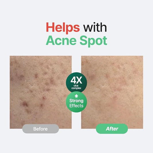 PURITO Centella Unscented Serum, 34,860 ppm Centella, Facial Serum for Sensitive Skin & Acne-Prone Skin, Soothing Serum, Vegan & Cruelty-Free, Korean Skincare, 2 fl.oz / 60ml