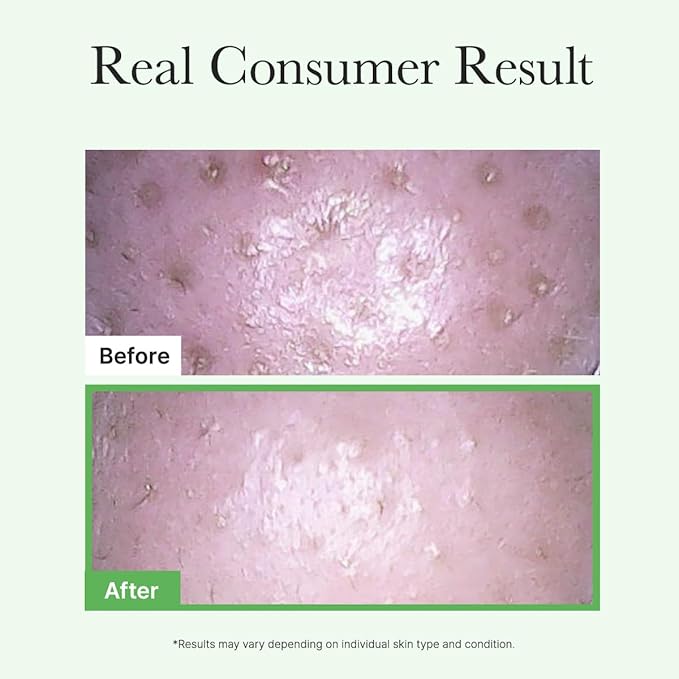 ARENCIA Pore Melt Mochi Makeup-Removing Cleansing Oil, Non-Comedogenic, Rice Amino Acids HD, Vitamin E, Cica, & Ceramide, 6.76 fl oz