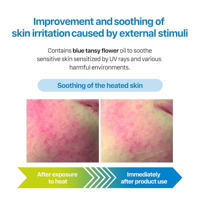 Real Barrier Aqua Soothing Cream 1.7 Fl.Oz. 50ml Hyaluronic Acid Facial Cream| Redness Relief Face Cream for Sensitive Skin | Face Moisturizer for Dry Skin| Calming Chamomile Extract| Korean Skincare