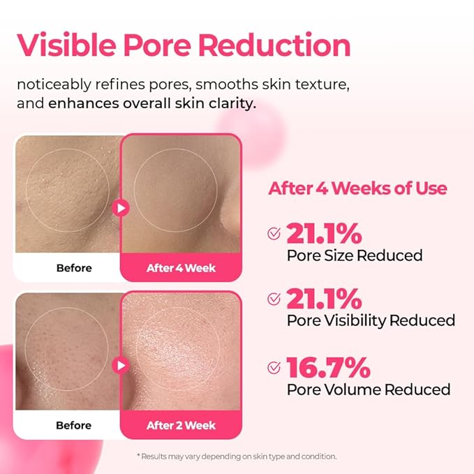 Dr.Melaxin Cemenrete Cyano Pink Spicule Serum with Calcium, korean skin care pore tightening refines pores tightening serum 1.01 fl. oz.