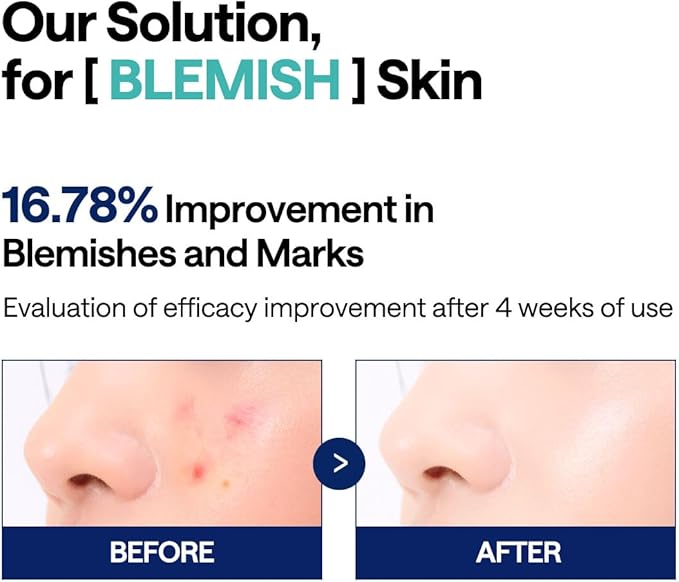 MEDIHEAL Madecassoside Toner Pads - with Centella Asiatica to Treat Blemishes and Improve Uneven Skin Tone - Vegan Gauze Fabric, 100 Pads