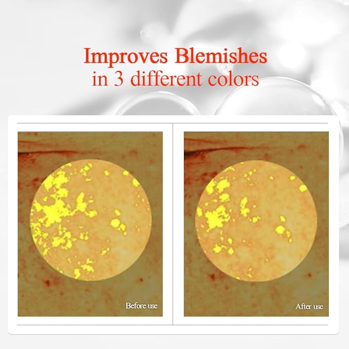 Pyunkang Yul PKY Radiance Vita Toner for Flawless and Radiant Skin, Blemish Care Toner with Vitamin C & Niacinamide, Zero Irritation, Korean Skincare (5.07 Fl. Oz, 150ml)