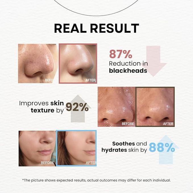 MPC Bubble Pore Cleanser, Korean Face Wash, Gentle Deep Pore Facial Cleanser with Caviar, Blackhead Makeup Remover, Pore Minimizer, Hydrating, Exfoliator, Oily, Dry Skin 10.1 fl oz