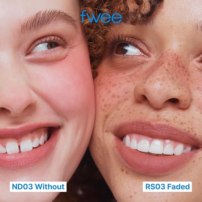 fwee Blurry Pudding Pot + Keychain SET | Airbrushed Blush & Lip, Buildable Pigment, Long-lasting, Lightweight, Easy to Blend, Natural Soft Matte Finish Makeup – Lyrics (Rose Brown) | 0.17 oz