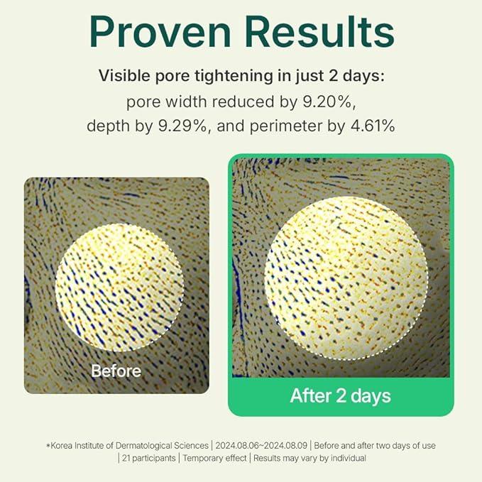 Centellian 24 Madeca Powder Tea Tree AC (Soothing Powder, 0.21 oz) – Oil Control & Pore-Tightening for Acne-Prone Skin, Korean Skin Care. Hyper-TECA™ Tea Tree, Allantoin.