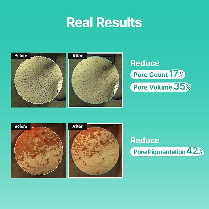 Porethera Real Bifida Blur Cream - Korean Face Moisturizer - Pore Minimizer Face Tone-Up Cream for Blurring Face - Pore Regenerating - Facial Moisturizer for Oily and Acne-Prone Skin, 1.69 fl.oz