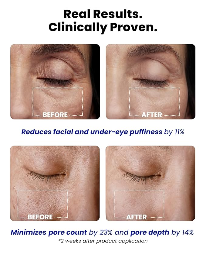 Ice Roll Serum - Cooling Serum with Face Massager Roller for Under Eye Bags, Puffiness, Dark Circles, Hydrating & Pore Minimizing with Panthenol, Tannin - Korean Skin Care, 1.69 Fl Oz (50ml)