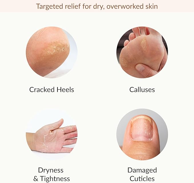 Epielle Hydrating & Moisturizing Hand & Foot Masks 12 Pairs, Relieve and Soften Dry Hands & Cracked Heels with Shea Butter & Sunflower Seed Oil, Korean Skin Care, Spa Set, Self Care Gifts for Women