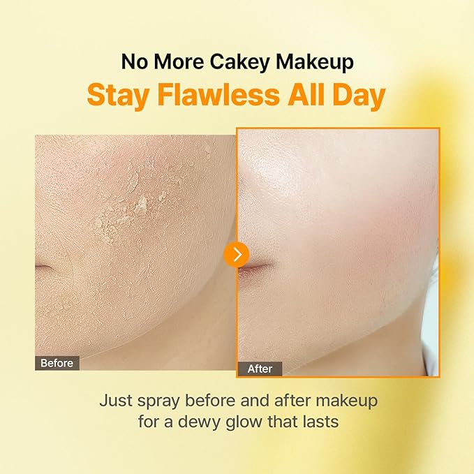 Vitamin C Glow Mist for Radiant Skin, Hydrating Serum Mist with Niacinamide & Glutathione, Korean Vegan Skincare, 3.38 Fl Oz