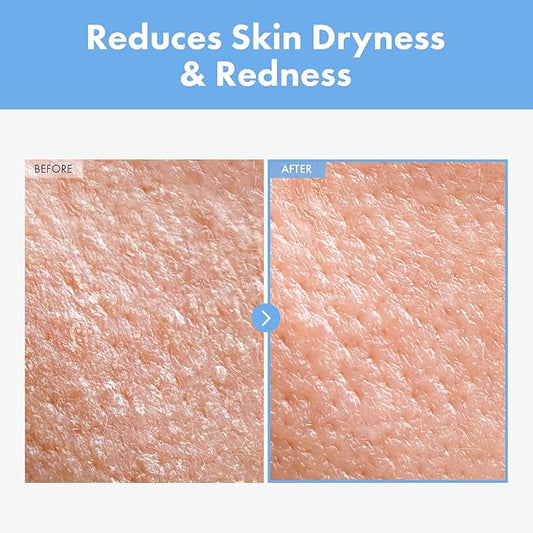 Cica Panthenol Cream, 50,000ppm Panthenol, Centella Asiatica & Hyaluronic Acid, Barrier Repair Moisturizer for Dry, Sensitive Skin, Korean Skincare, 150g, 5.29 oz.