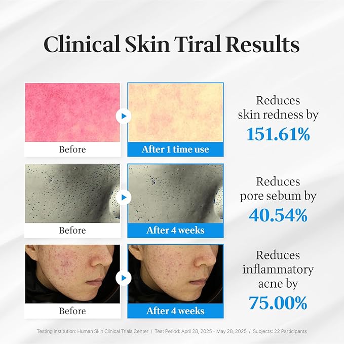 Cica Face Moisturizer with Pro-Vitamin B5 – Daily Hydrating Cream for Dry and Delicate Skin – With Panthenol, Squalane & Glycerin – Lightweight Skin Barrier Support, Day & Night, 2.2 Fl Oz.