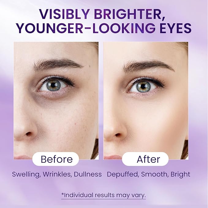 Caffeine & Retinol Under Eye Serum – Dermatologist-Tested, Fast Absorbing, Correction for Puffy Eye Bags Fine Lines Dark Circles Wrinkles While Providing Moisturizing Care-FX