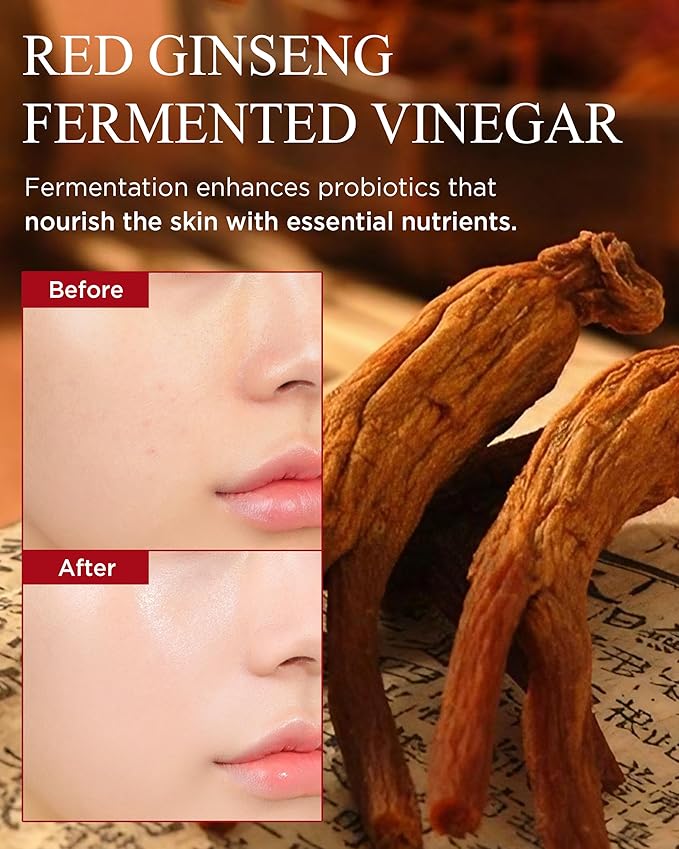 Bonyongo Red Ginseng Vinegar Skin Toner – Refreshing & Moisturizing Face Toner for Smooth, Youthful Skin - with Fermented Red Ginseng - Korean Skincare, 5.07 fl.oz.