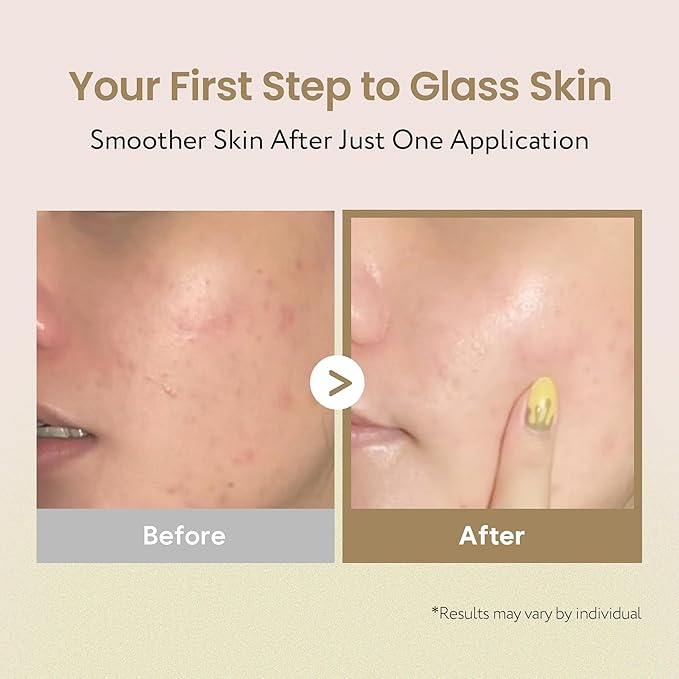 Coconut Rice Milk Toner | Calming Hydration, Smooth Skin Texture and Strengthen Skin Barrier with Rice, Panthenol, Ceramide, AHA | Fragrance-Free, Korean Skin Care (150ml/ 5.07 fl oz)