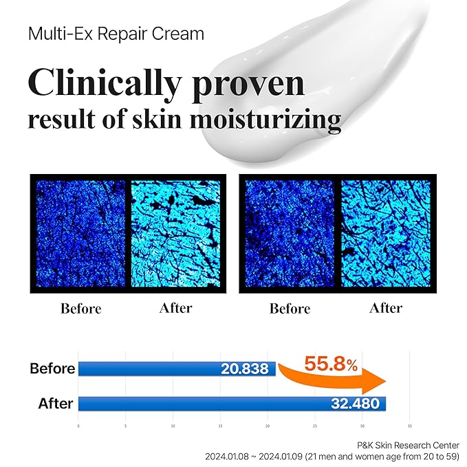Multi-Ex Repair Cream 50ml – Korean Face Moisturizer with Niacinamide & EGF | Skin Repair Cream for Sensitive Skin | Soothing Facial Moisturizer for Women | Hydrating Moisture