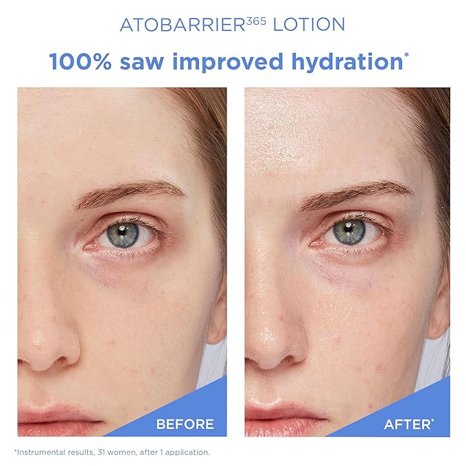 AESTURA ATOBARRIER365 Lightweight Korean Face Moisturizer with Ceramides | Strengthens Barrier, Fast-Absorbing Hydration, Suitable for Dry, Normal & Sensitive Skin, 90ML / 3.04 fl. Oz.