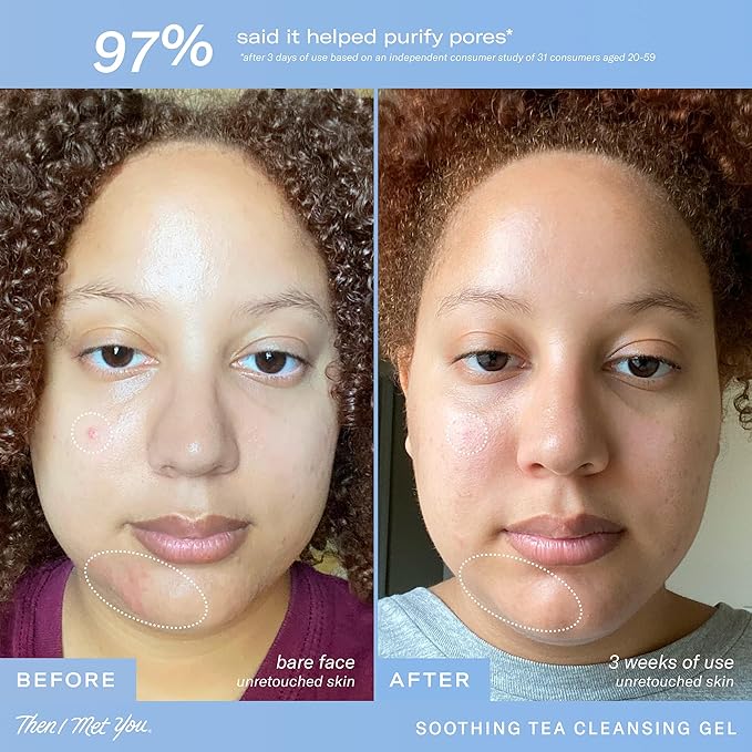 Then I Met You Soothing Tea Cleansing Gel, Vegan-Cruelty-Free Korean Skincare Cleanser with Fermented Rice, Centella, Hydrating Licorice, Glycerin, Exfoliator for Clear Skin Makeup Removal, 3.38 oz